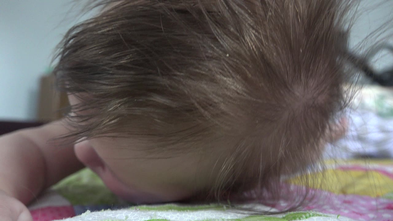 At 0:00 in Westminster, Colorado, a baby lies face-down on a patterned bedspread, with the top of the head closest to the camera and the face mostly hidden.