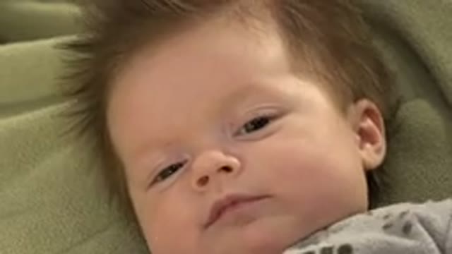 WESTMINSTER COLORADO-2015: A White Little Baby Is Moving His Head And Face While Lying Down
