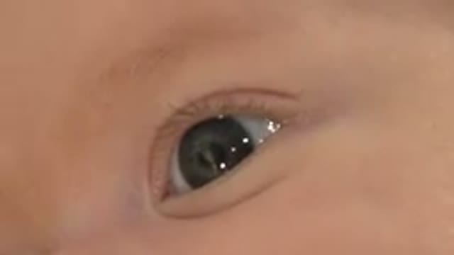 WESTMINSTER COLORADO-2015: A Close Up Of A Baby's Eye Looking Glossy