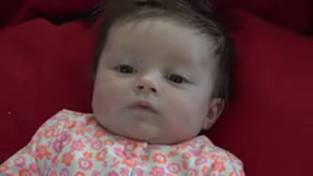 WESTMINSTER COLORADO-2015: Hairy Baby Lies in Bed During the Day