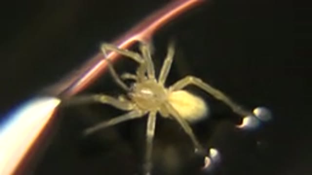 Small Image Of A Spider Next To What Looks Like A Hair Follicle